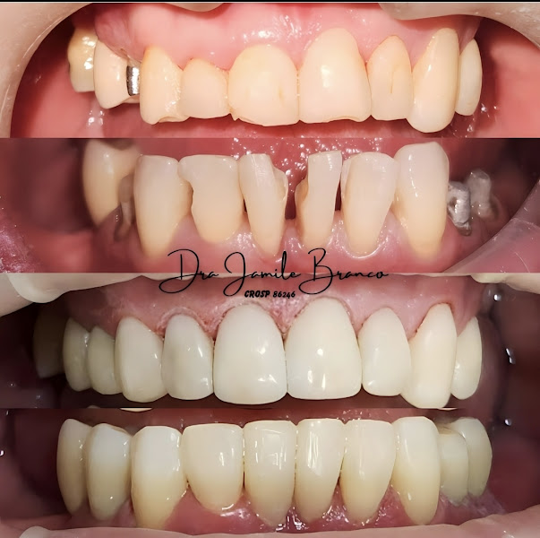 Foto 2 de MODELO ODONTO - Dra Jamile Branco / Dr João Paulo Alves/Dra Lara Melo/Dr Matheus André
