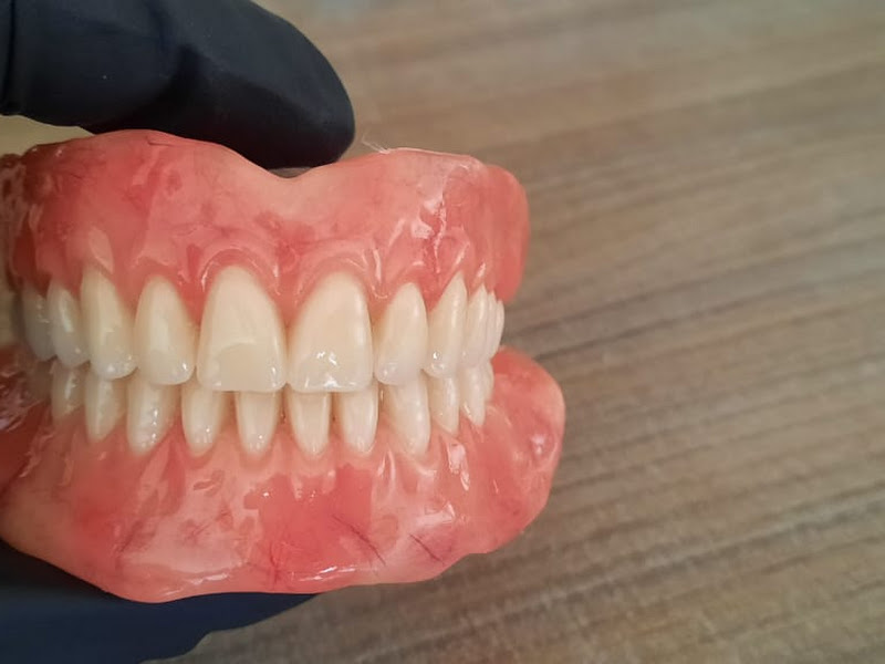 Foto 3 de Modelo Prótese Dentaria