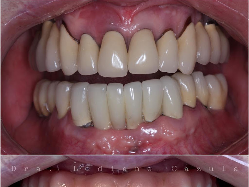 Foto 3 de Modular Odontologia Especializada - Unidade Avelãs