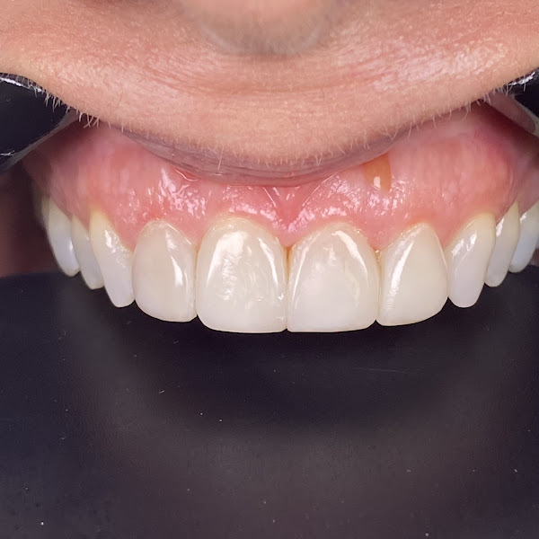 Foto 4 de Mogno Odontologia e Estética facial