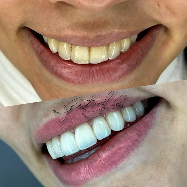 Foto 3 de Mond Clinic - Clinica Odontológica e Harmonização