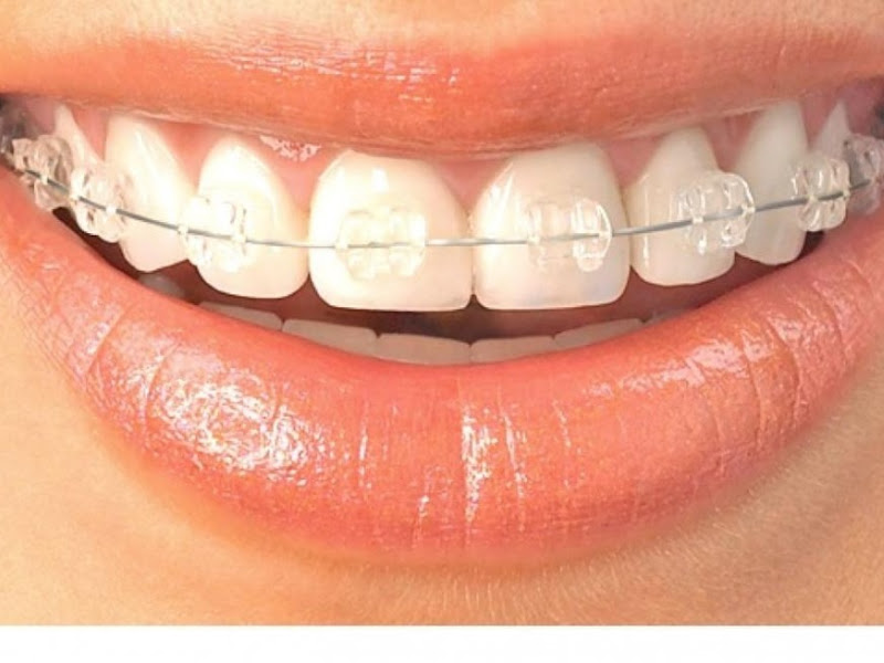 Foto 3 de Moraes Odontologia