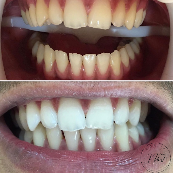 Foto 2 de Morais Odontologia e Harmonização Facial