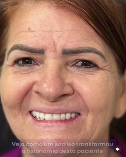 Foto 2 de Moritz Odontologia - Clínica Odontológica Pirituba