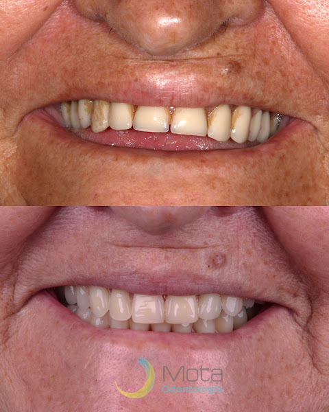 Foto 3 de Mota Odontologia Aparecida | Implantes, próteses e estética em Aparecida de Goiânia