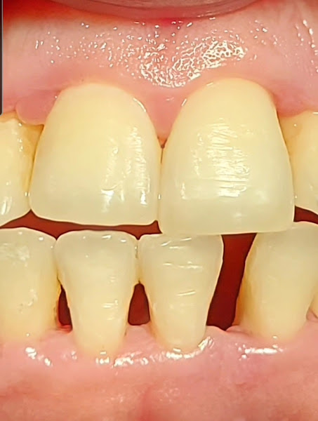 Foto 2 de Mousse Odontologia