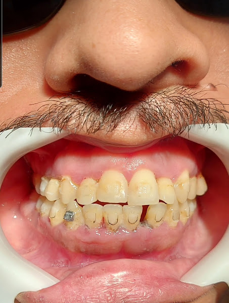 Foto 3 de Mousse Odontologia