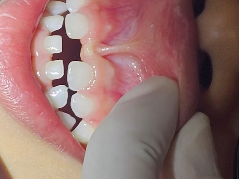 Foto 4 de Mouzari Odonto Clinic & Mouzari Kids Odontopediatria