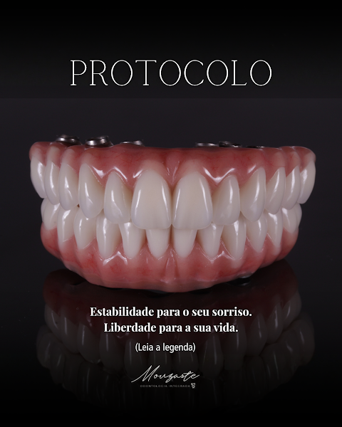 Foto 3 de Mouzarte dentista em Niterói - RJ | Implante Dentário