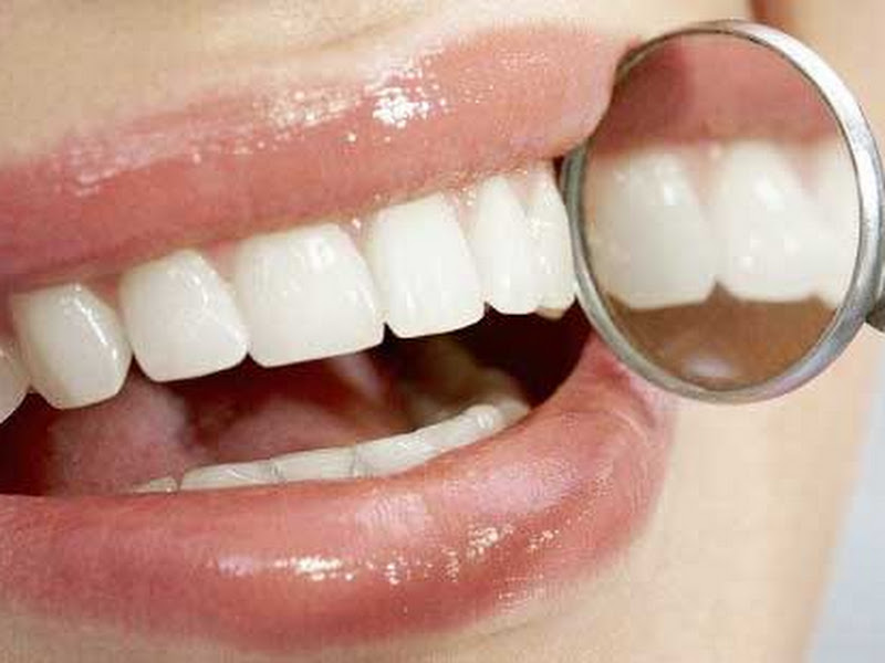 Foto 8 de Moysés Flaksberg Cirurgião Dentista