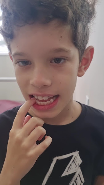 Foto 4 de MR Odontologia - Reabilitação Estética e Ortodontia