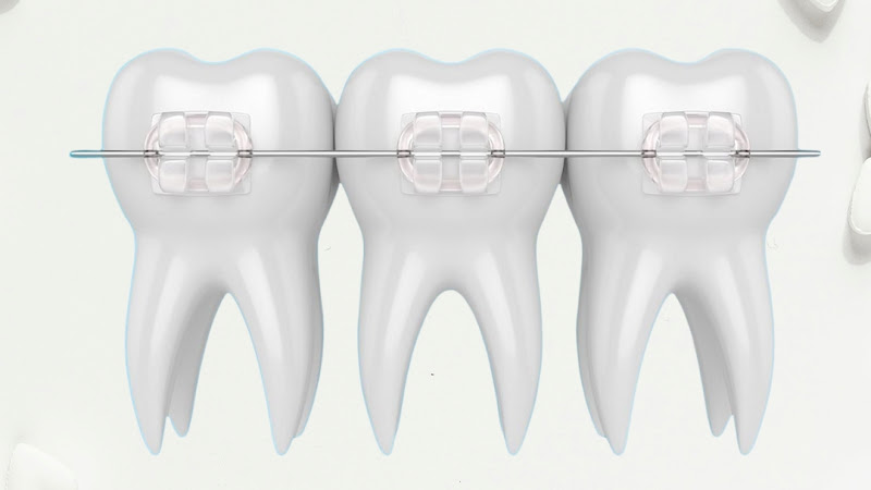 Foto 2 de MRV Odontologia Taboão da Serra