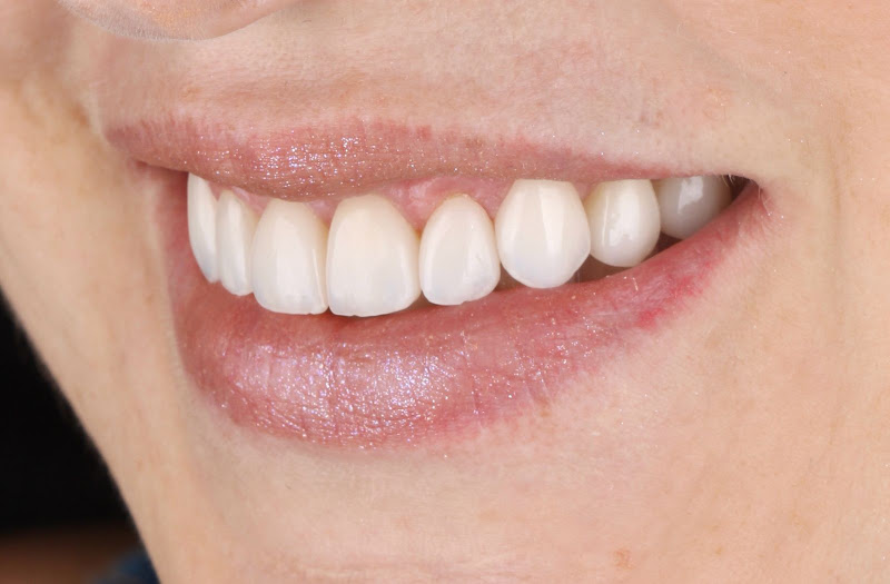 Foto 3 de MS ODONTOLOGIA ESPECIALIZADA