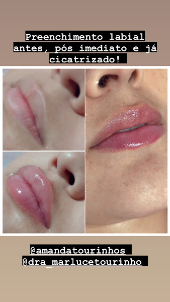 Foto 2 de MT Estética e Saúde