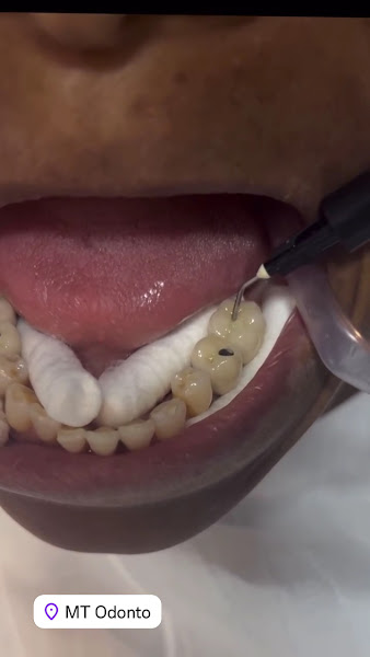 Foto 5 de MT odonto