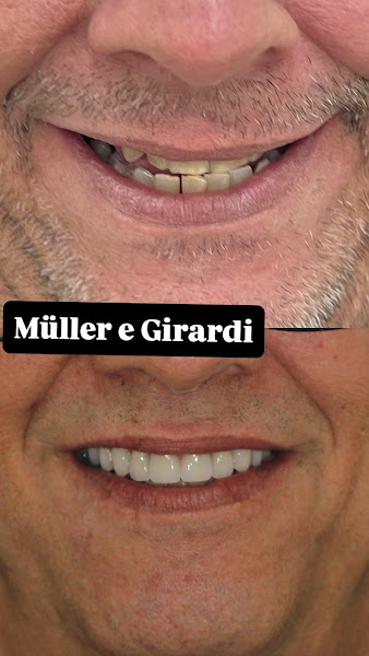 Foto 3 de Müller & Girardi - Clínica odontológica em Maringá | Implantes | Prótese | Facetas | Canal | Aparelho Dentário