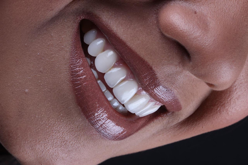 Foto 3 de Mult Sorriso Curitiba