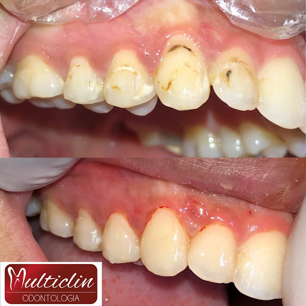 Foto 2 de Multiclin Odontologia Araucaria