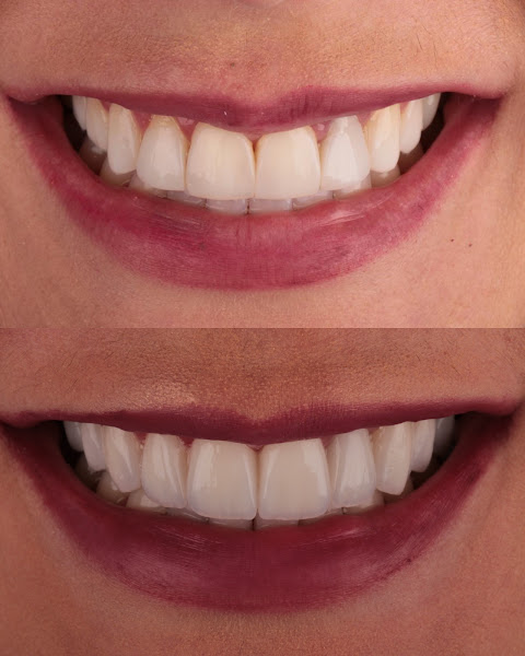 Foto 3 de Multisorrisos Odontologia - Unidade Buriti
