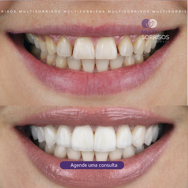 Foto 2 de Multisorrisos - unidade garavelo