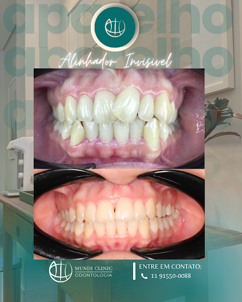 Foto 2 de Mundi Clinic Odontologia