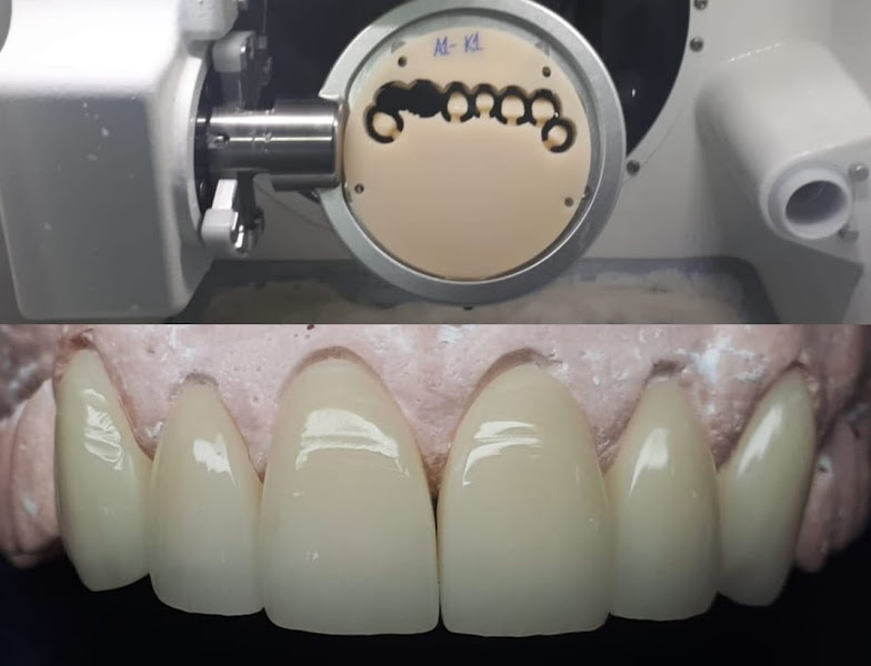 Foto 3 de Murilo Gontijo Dental Lab