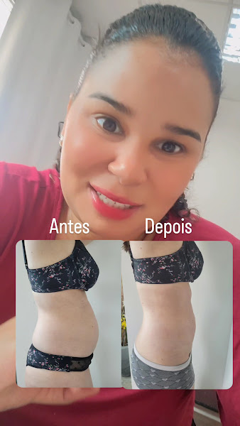 Foto 2 de N J- Estética Avançada