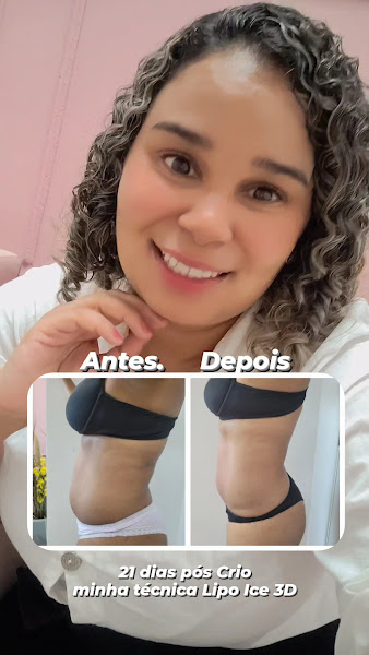 Foto 3 de N J- Estética Avançada