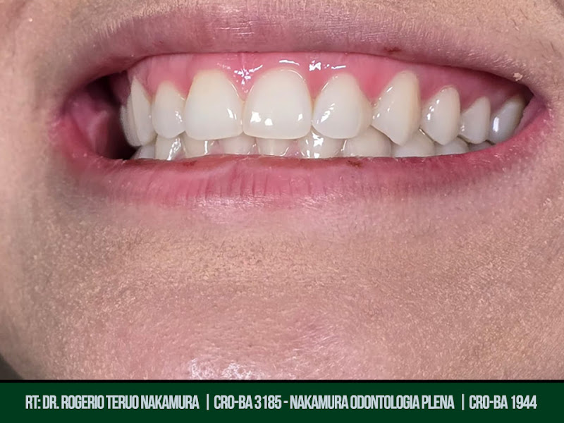 Foto 3 de Nakamura Odontologia Plena - Dentistas em Barreiras - BA