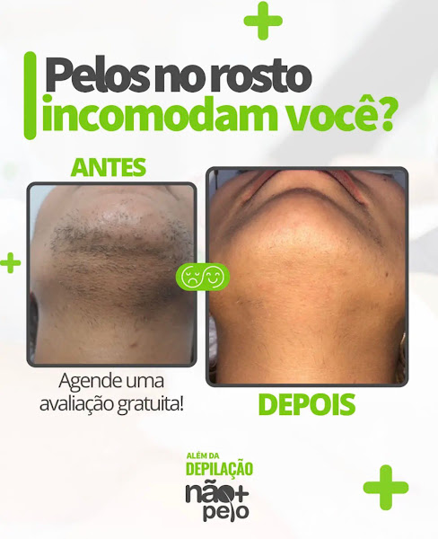 Foto 3 de Não Mais Pelo Pedreira