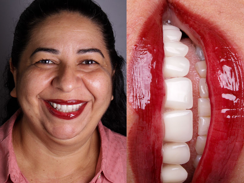 Foto de Nascimento Implantes e Odontologia