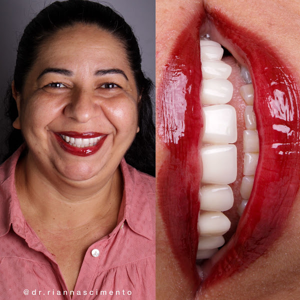 Foto 2 de Nascimento Implantes e Odontologia