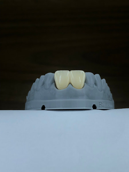 Foto 3 de Nassif Dental Studio Lab