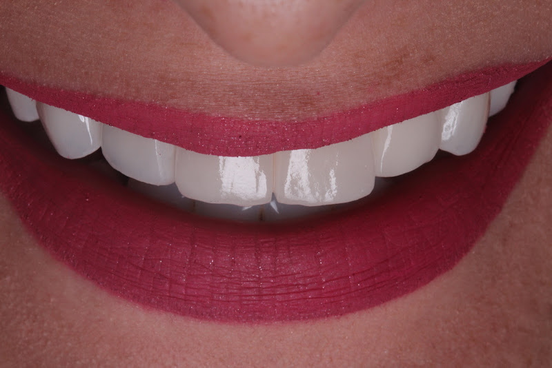 Foto 3 de Natal Oral Center | Clínica Odontológica Integrada