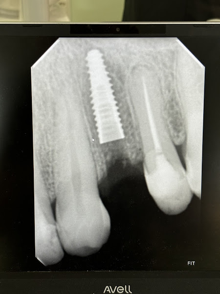 Foto 2 de Natan Damaceno ( Dentista em Teresina)