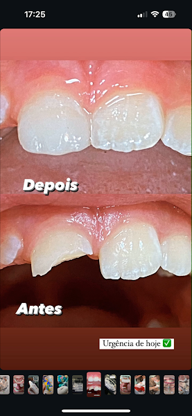 Foto 3 de Natan Damaceno ( Dentista em Teresina)