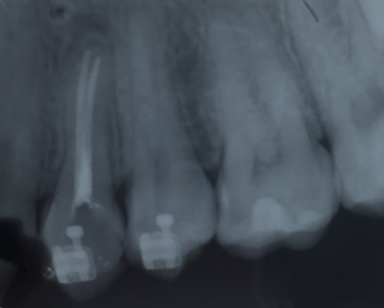 Foto 3 de Nathãnna Krizia