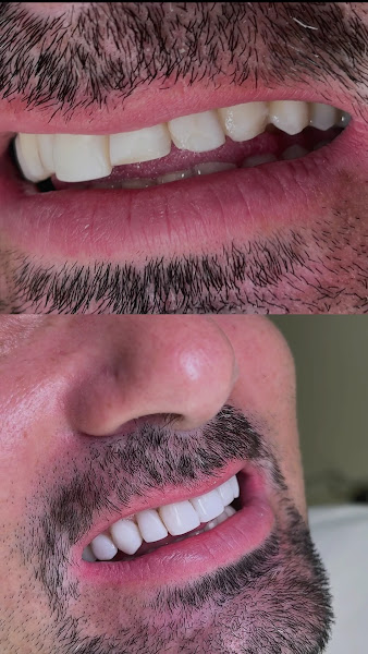 Foto 2 de NC White Odontologia Integrada - Implantodontista e Protesista