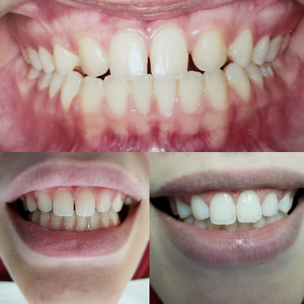 Foto 3 de Neila Marques - Cirurgiã Dentista