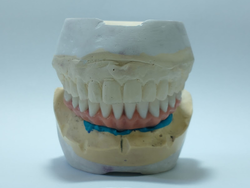 Foto 2 de Neimar Gonçalves Prótese Odontológica