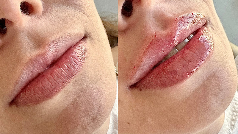 Foto 2 de NEO - Núcleo Estético Odontológico