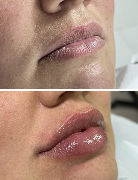 Foto 3 de NEO - Núcleo Estético Odontológico