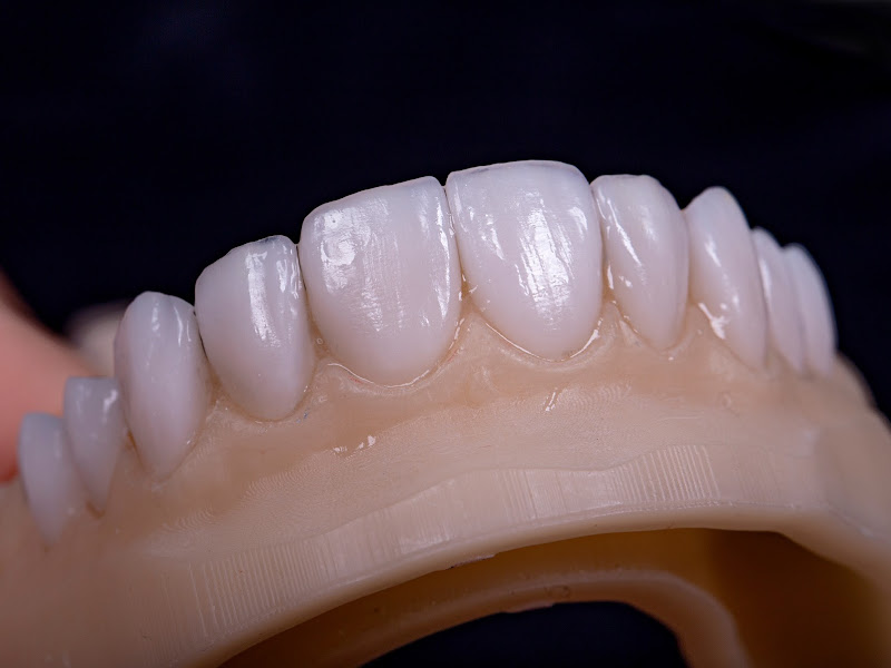 Foto 6 de NEOB - Odontologia Especializada