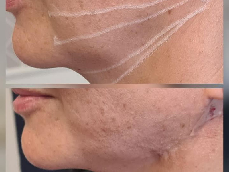 Foto 3 de Neolago Estética Facial e Odontologia