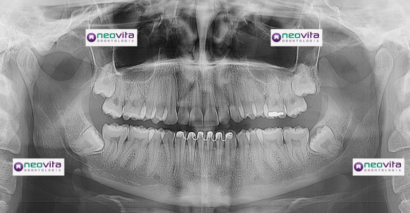 Foto 3 de Neovita Odontologia