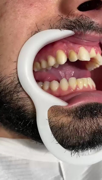 Foto 3 de Neves Cabral Odontologia Especializada