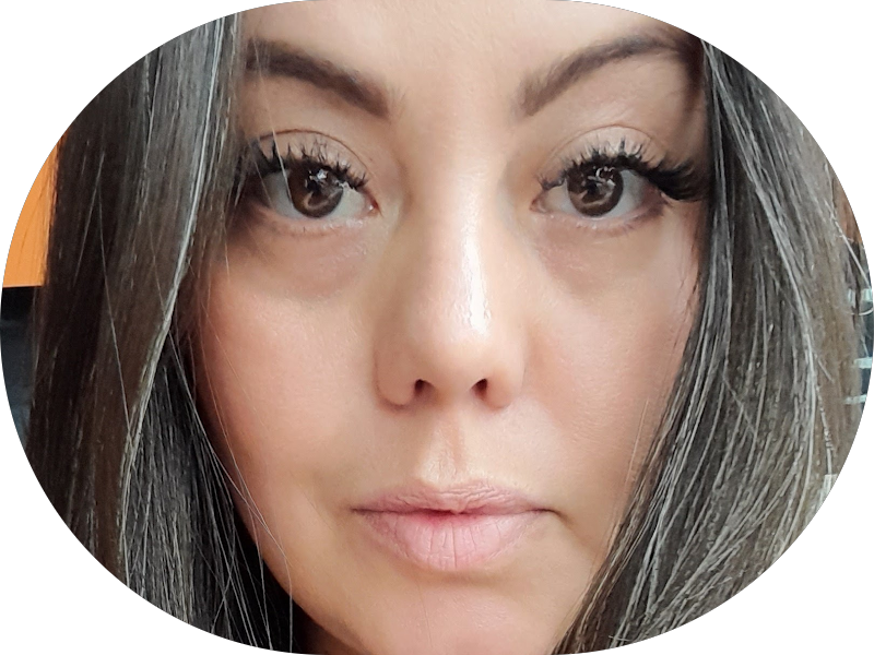 Foto 5 de NewSmile ARTE EM ESTÉTICA ODONTOLÓGICA