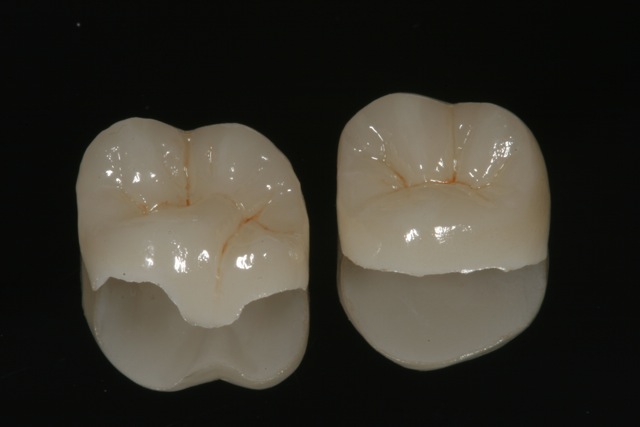 Foto 3 de Newton Rodrigues - Odontologia Estética