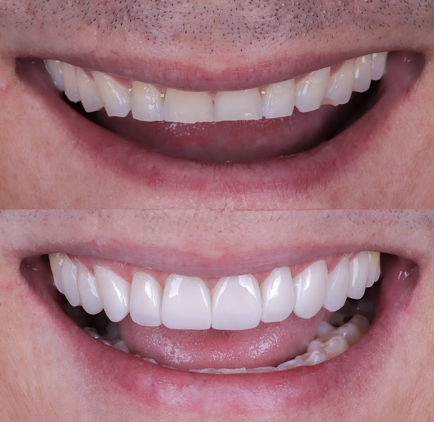 Foto 3 de Nice Odonto Barbacena Facetas Lentes Implantes