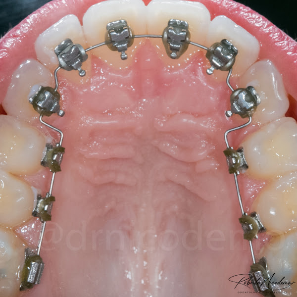 Foto 3 de Nicodemo Odontologia Estética